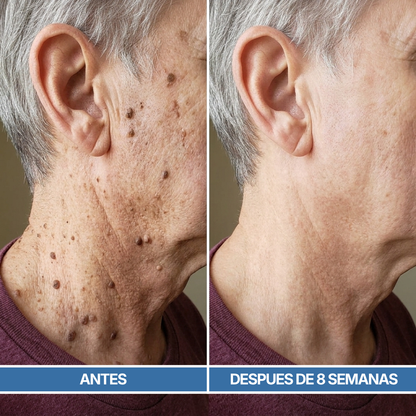 ZY Renueva 40 | Crema Para Piel Áspera y Elevada